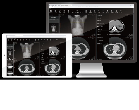 Advantages of web-based DICOM Viewer