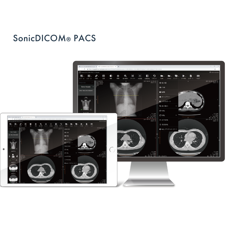 Picture Archiving and Communication System / DICOM Viewer SonicDICOM PACS