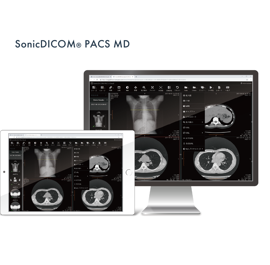 医用画像管理システム Sonic DICOM PACS