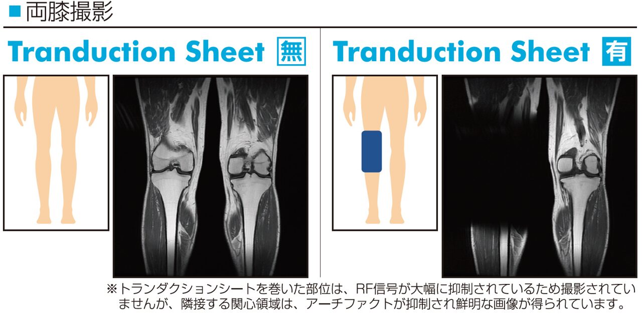 RFによる発熱を抑制