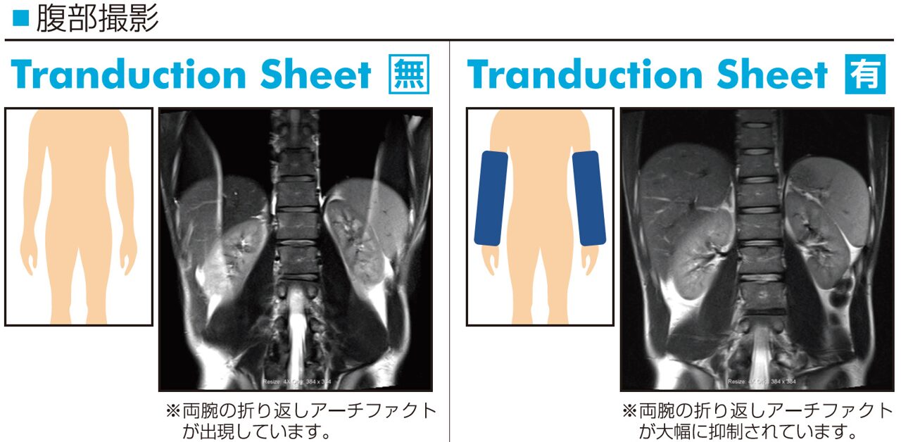 MRI撮影時の折り返し画像の抑制策として